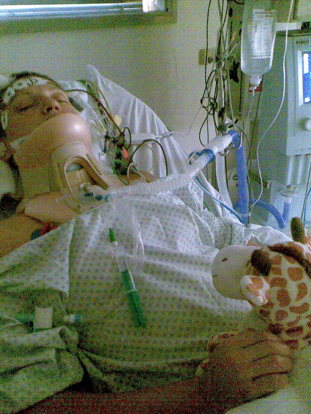 Nach dem Unfall – künstliches Koma, die schwerste Zeit.