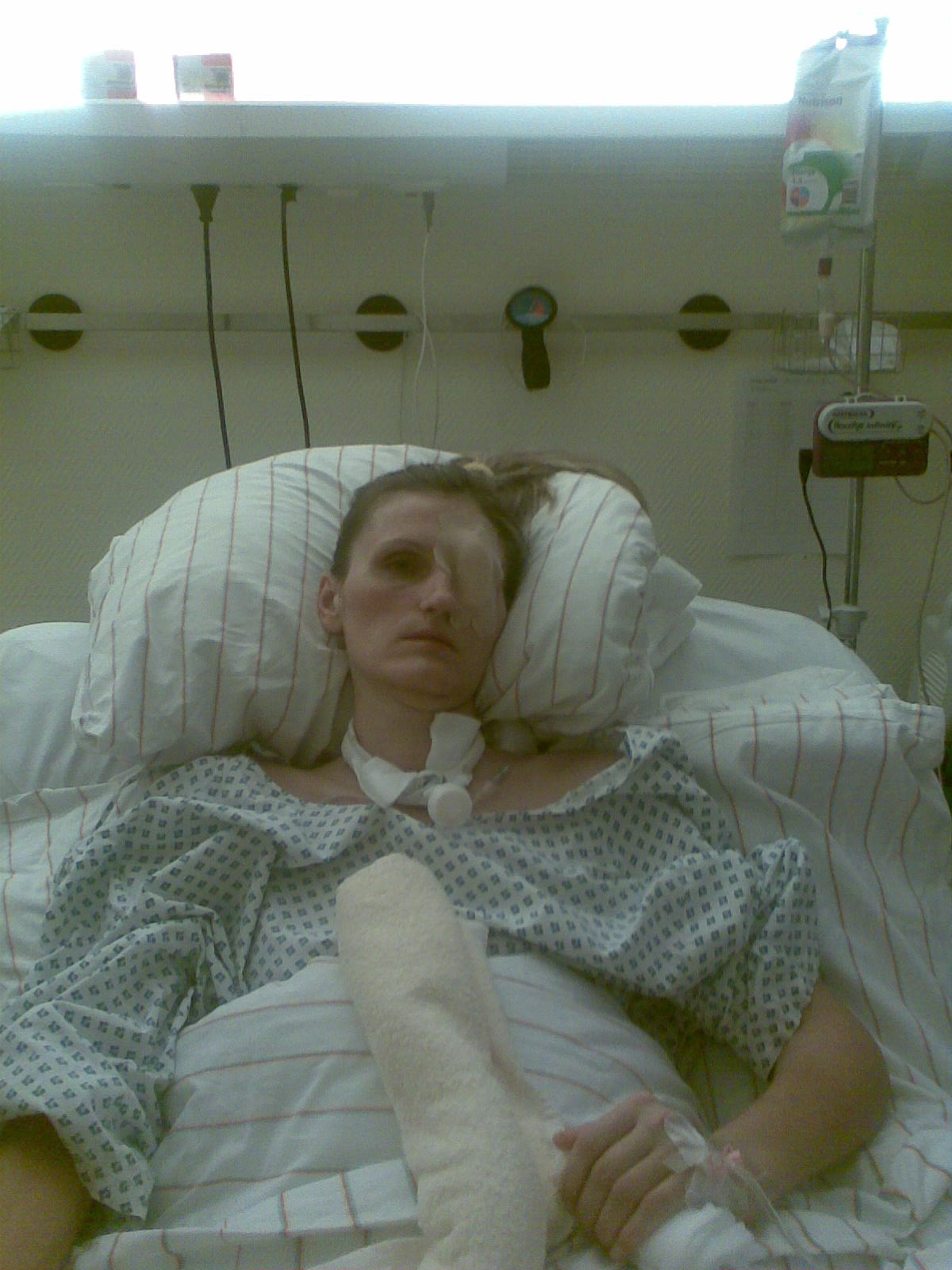 Yuliya im Wachkoma – Klinikkaufnahme.